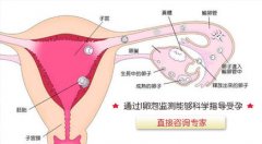 卵泡监测如何做，不再是困恼