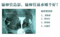 在泉州做输卵管通水贵吗?
