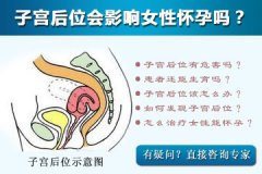 子宫后位如何受孕？