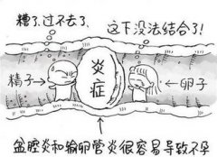 输卵管炎是怎么一回事?