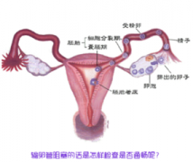 B超可以检查出输卵管堵塞吗?