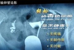 造影后多久可同房呢？