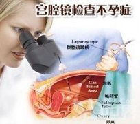 做宫腔镜检查疼吗?