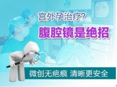 宫外孕会影响怀孕吗?