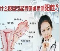 抗卵巢抗体怎么来测定呢?