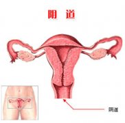 阴道炎对怀孕有影响吗?