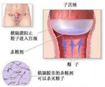宫颈粘液抗精子抗体是怎么一回事呢?