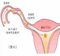 卵泡破裂后会怀孕吗?