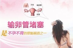 怎么样才知道输卵管堵塞？