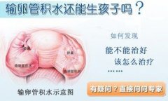 输卵管积液能怀孕吗?