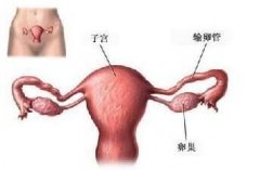 输卵管炎症