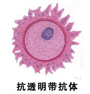 抗透明带抗体阳性