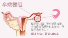 女性输卵管伞端不通怎么治疗