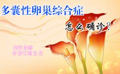 多囊卵巢综合症要做哪些检查