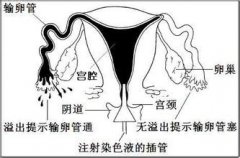 造影前注意事项