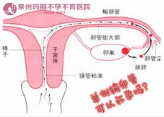 宫外孕切除输卵管后还能怀孕吗?