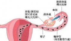 输卵管通而不畅怎么办？