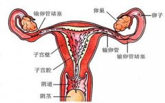 输卵管堵塞怎么治疗好呢?