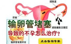 输卵管堵塞专家咨询