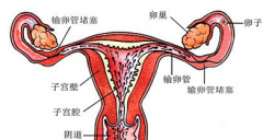 人流后会引起输卵管堵塞