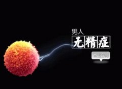 检查无精多少钱