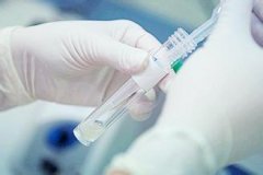 精液存活怎么检查