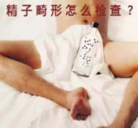 精子畸形检查多少钱