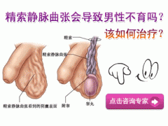 精索静脉曲张会导致男性不育吗
