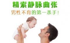 如何治疗精索静脉曲张