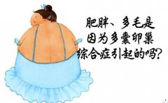 关于多囊卵巢综合症