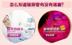 如何检测输卵管堵塞