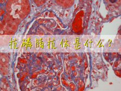 抗心磷脂抗体不孕是怎么回事