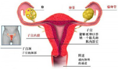 输卵管复通后为什么不能怀孕？90%以上是这两种